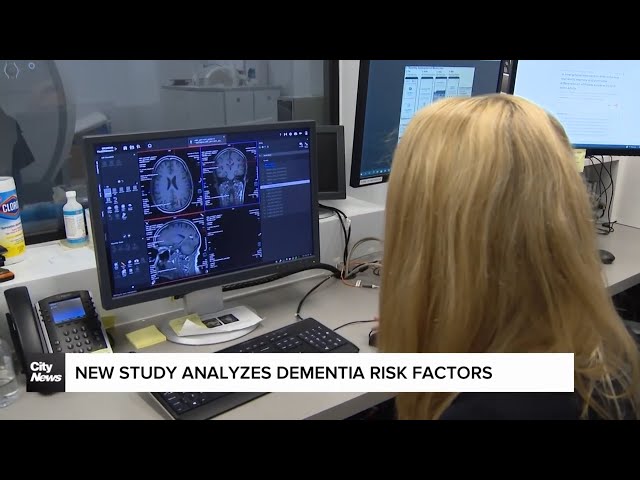 ⁣Dementia risk factors identified by Toronto researchers in new study