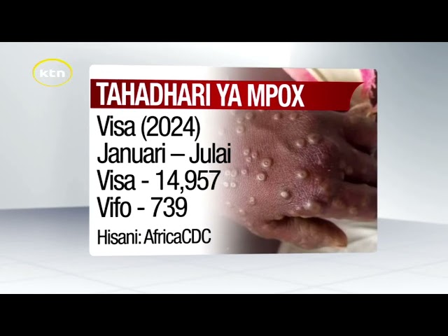 ⁣Mataifa ya Afrika yahofia mlipuko wa Mpox