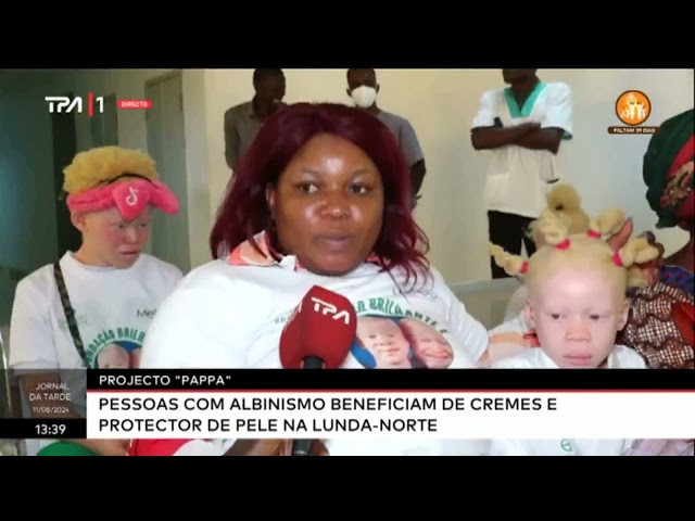 Projecto "PAPPA" pessoas com Albinismo bebeficiam de creme e protector de pele na Lunda-No