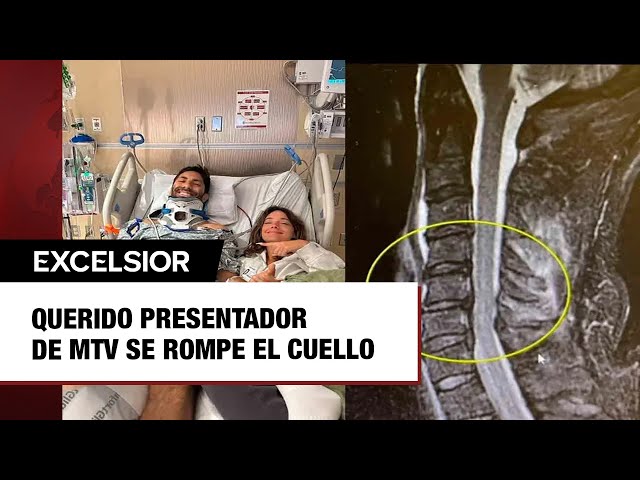 Querido presentador de 'Catfish', de MTV se rompe el cuello en trágico accidente en bicicl