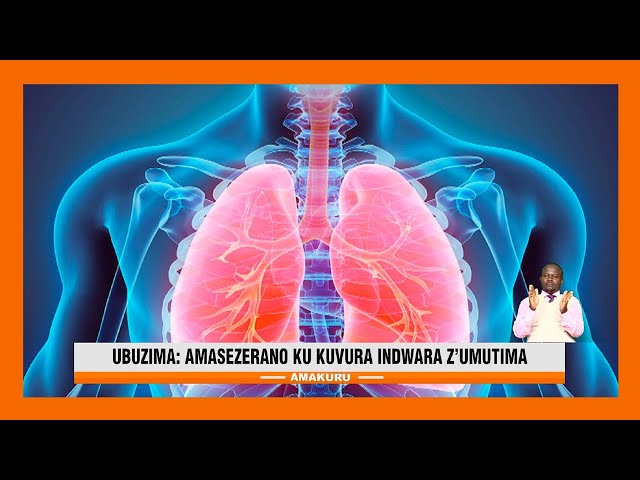 ⁣Rwanda - Misiri: Hatanzwe ibikoresho bya miliyoni 3$ bizakoreshwa mu bitaro bivura umutima