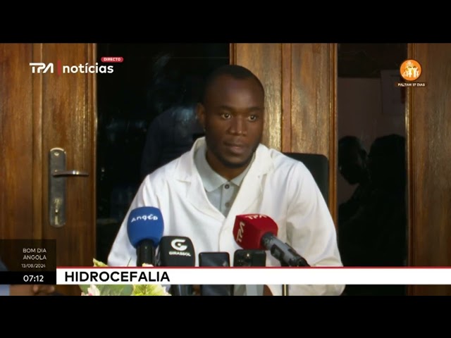 Hidrocefalia - Hospital Central do Lubango realiza campanha de cirurgia a crianças até aos 5 anos