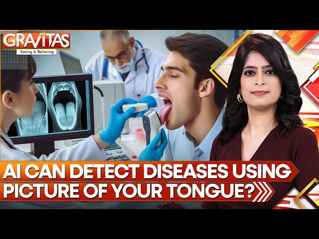 ⁣AI model diagnoses diseases by analysing tongue's colour | Gravitas | World News | WION