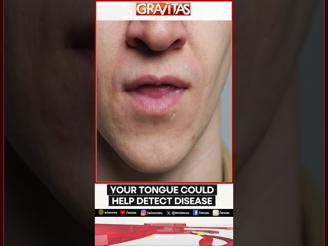 ⁣Your tongue could help detect disease | Gravitas | WION Shorts