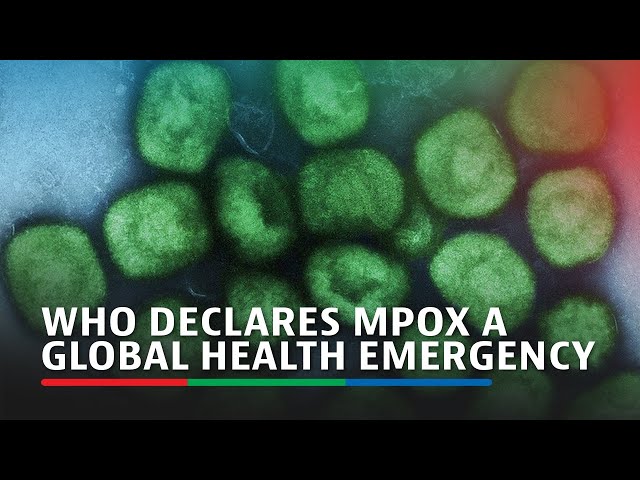 WHO declares mpox a global health emergency | ABS-CBN News