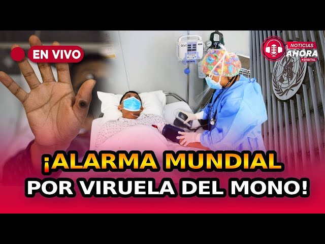  ¿Nueva pandemia? Viruela del mono  fue declarada nueva emergencia de salud pública internacional