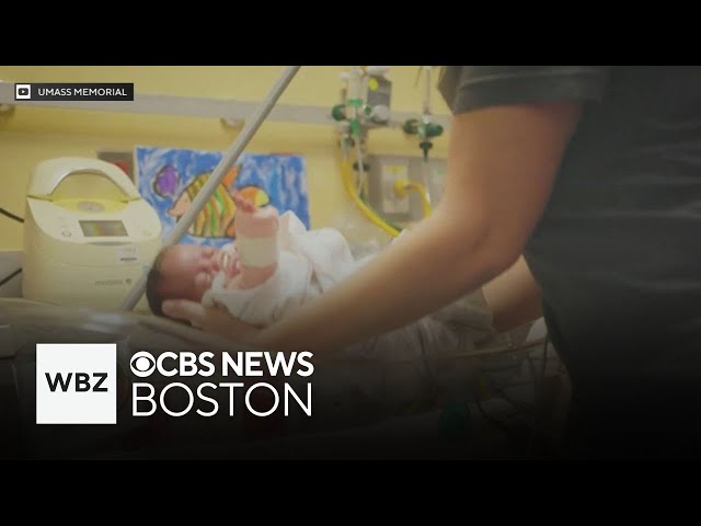 ⁣UMass Memorial NICU to celebrate 50th anniversary with NICU babies' reunion