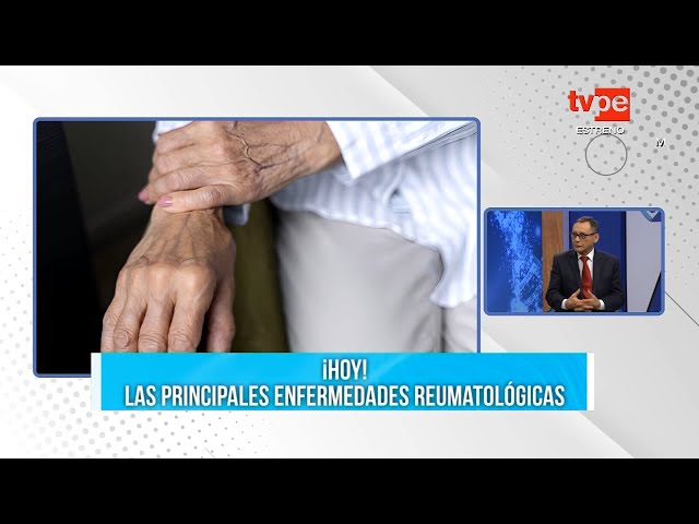 Dr. TB (16/08/2024) | TVPerú