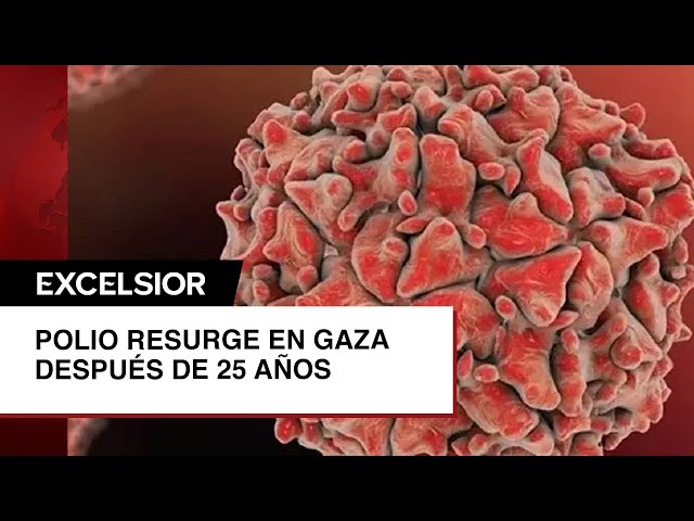 Gaza registra su primer caso de polio en 25 años; ONU pide “pausas humanitarias”