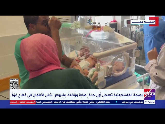 الصحة الفلسطينية تسجل أول حالة إصابة مؤكدة بفيروس شلل الأطفال في قطاع غزة