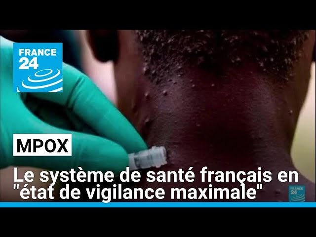 Mpox : le système de santé français en "état de vigilance maximale" • FRANCE 24