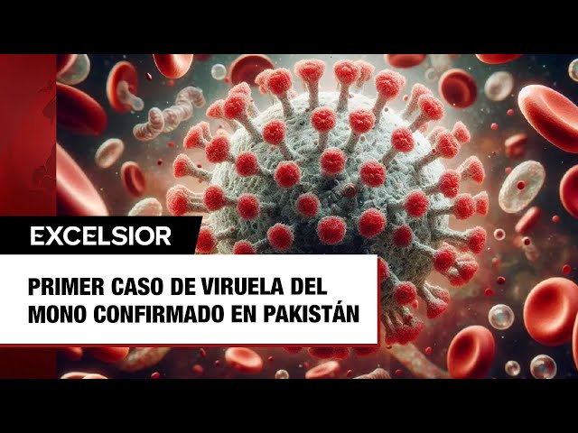 Primer caso de viruela del mono confirmado en Pakistán