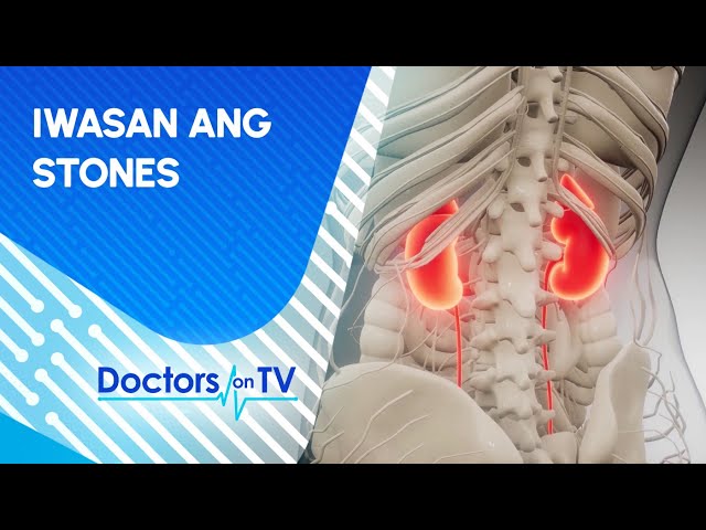 ⁣Ano ang proper diet modification para maiwasan ang kidney stones?