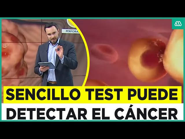 Un simple test podría cambiarlo todo: Sencilla prueba puede detectar cáncer gástrico