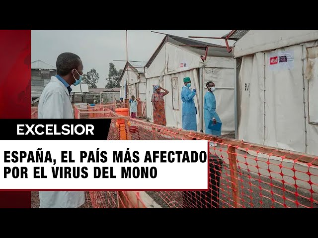 Viruela del mono: España el país de Europa con el mayor número de casos de mpox