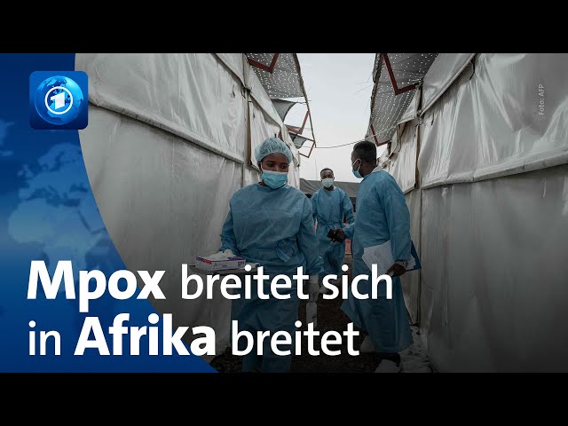 ⁣Mpox-Virus breitet sich in Afrika aus