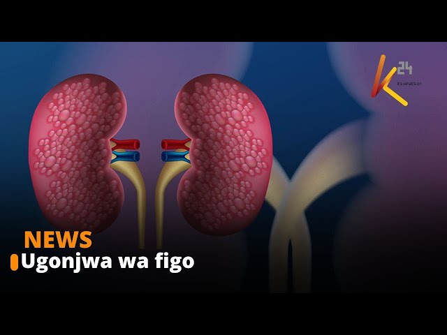 ⁣Wataalamu watoa wito kwa wakenya kukumbatia utamaduni wa kufanyiwa uchunguzi wa ugonjwa wa figo