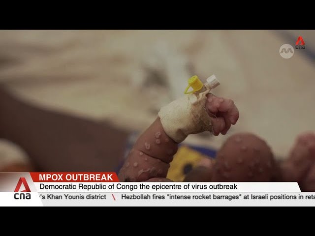 Congo expects to receive mpox vaccines from US, Japan