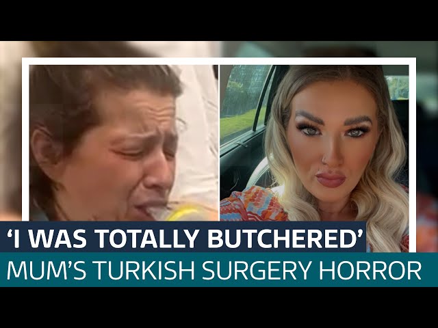 ⁣'I was totally butchered': Mum-of-four was awake during botched Turkey surgery | ITV News