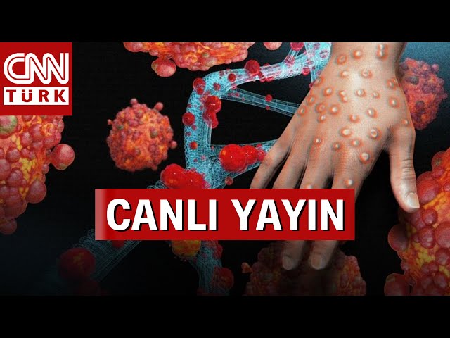 ⁣Dünya Alarmda: Maymun Çiçeği Virüsü Yayılıyor! Tekrar Kapanma Olacak Mı?  #CANLI