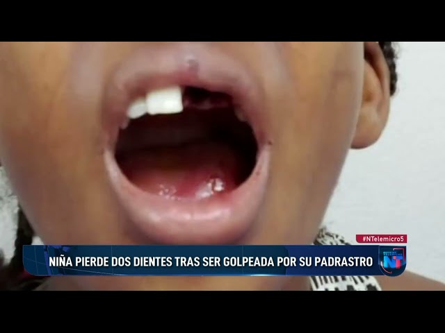 ⁣Niña pierde dos dientes tras ser golpeada por su padrastro