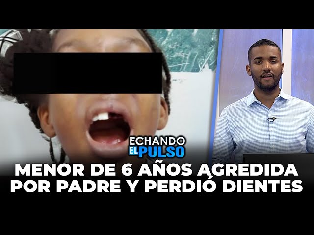 ⁣Esta menor de 6 años fue agredida por su padre y perdió dientes | Echando El Pulso