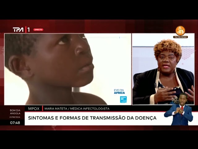 Mpox - Sintomas e formas de transmissão da doença