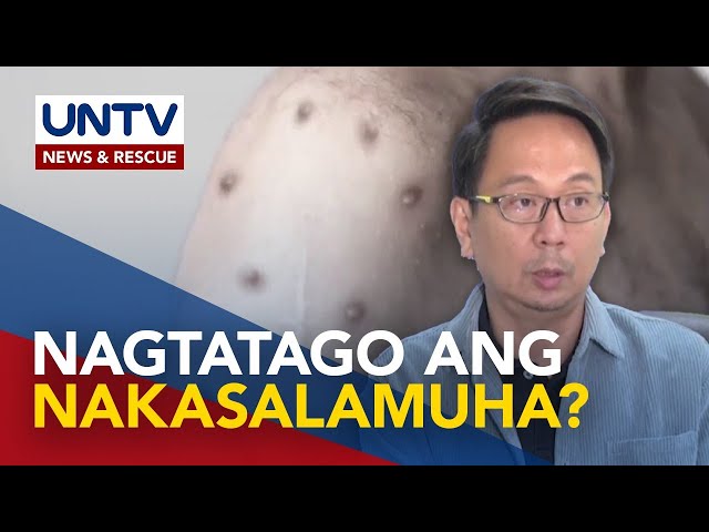 ⁣Closed contacts ng mpox case, pinayuhang mag-quarantine at huwag itago ang kondisyon