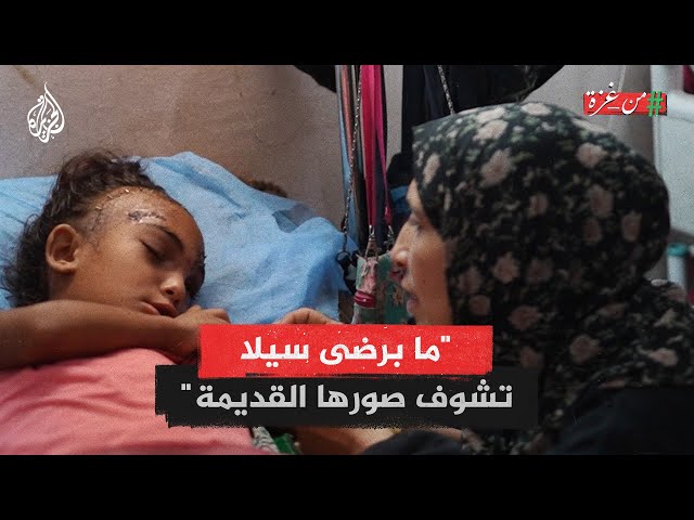 ⁣من غزة | أم الطفلة سيلا تطالب بعلاج ابنتها بالخارج بعد إصابتها في قصف مدرسة للنازحين بغزة