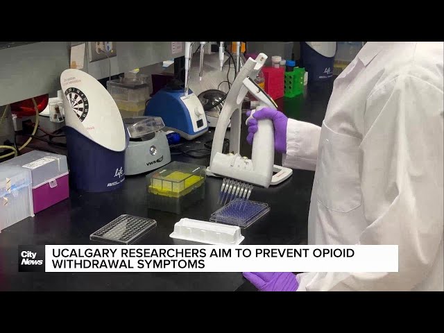 ⁣UCalgary researchers aim to prevent opioid withdrawal symptoms