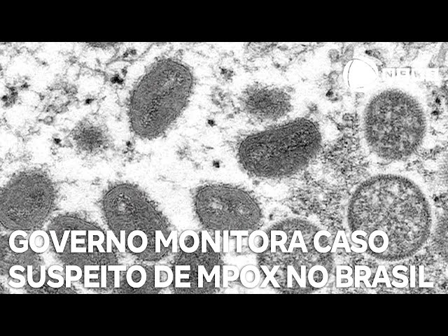 Governo monitora passageiro que chegou em Guarulhos com suspeita de mpox