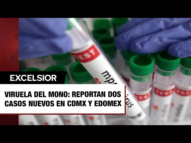 ⁣Viruela del mono: Reportan dos casos nuevos en CDMX y Edomex