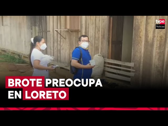 ⁣Loreto: adolescente de 16 años falleció a causa de infección meningocócica