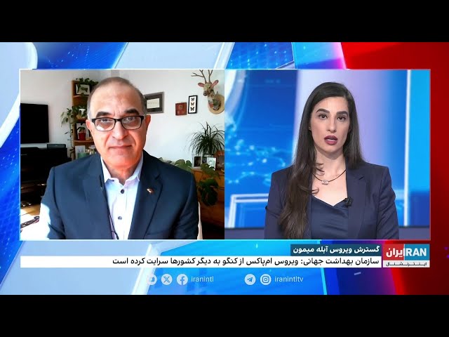 ⁣به گزارش سازمان جهانی بهداشت، ویروس آبله میمونی از کنگو به کشورهای دیگر سرایت کرده است