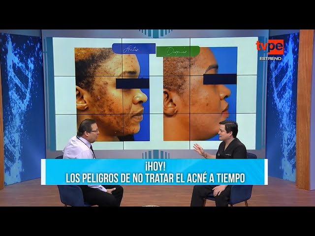 DR. TB (28/08/2024) | TVPerú