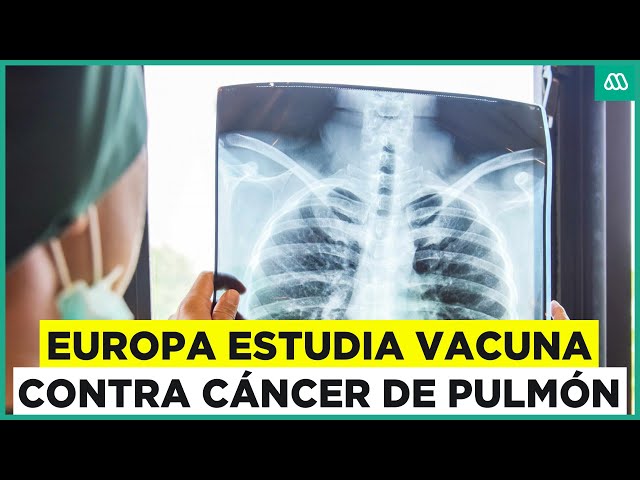 Prueban primera vacuna contra cáncer de pulmón en Europa