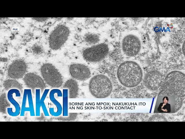 ⁣Saksi: (Part 2) Bantay-mpox; Laban kontra fake news