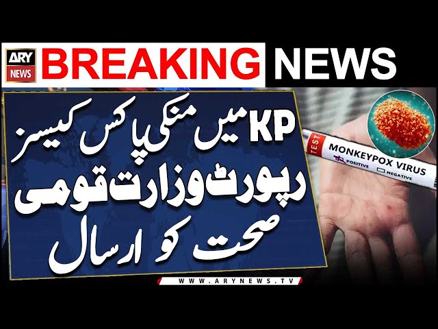 ⁣Mpox cases in KPK: Technical report sent to Ministry of National Health