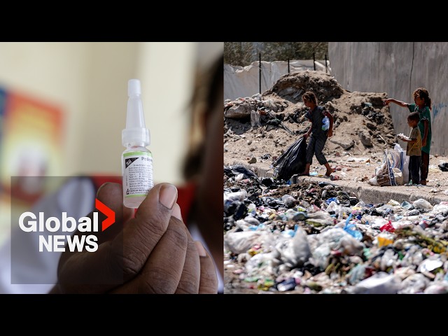 ⁣UNRWA launches polio vaccine campaign in Gaza after 1st case in 25 years