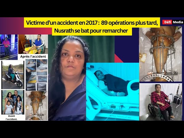 ⁣Victime d’un accident en 2017 :  89 opérations plus tard, Nusrath se bat pour remarcher