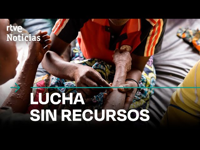 ⁣VIRUELA DEL MONO: La ESCASEZ de ALIMENTOS y MEDICINAS agrava la SITUACIÓN en el CONGO I RTVE