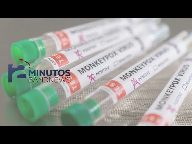 ⁣BandNews em 2 Minutos (03/09/24-Tarde) Rio de Janeiro registra 119 casos de Mpox