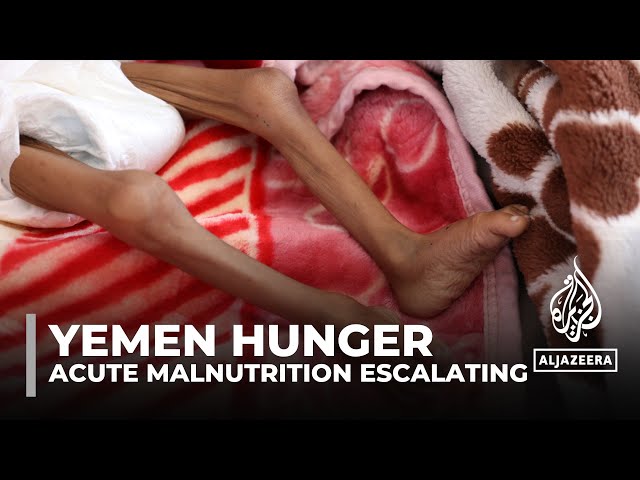 ⁣Famine looming in parts of Yemen, UN experts warn