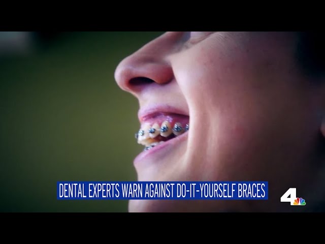 ⁣DIY Braces Trend On The Rise - The Rundown: Tuesday 9/3/24 | NBCLA