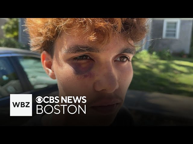 ⁣Massachusetts police open civil rights investigation after fight involving teenagers