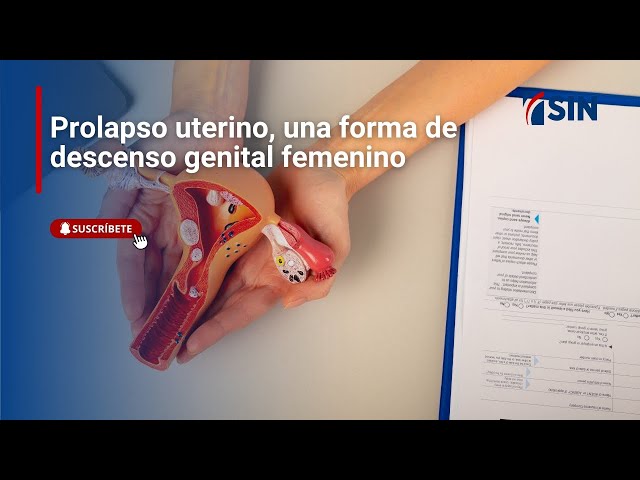 ⁣Prolapso uterino, una forma de descenso genital femenino