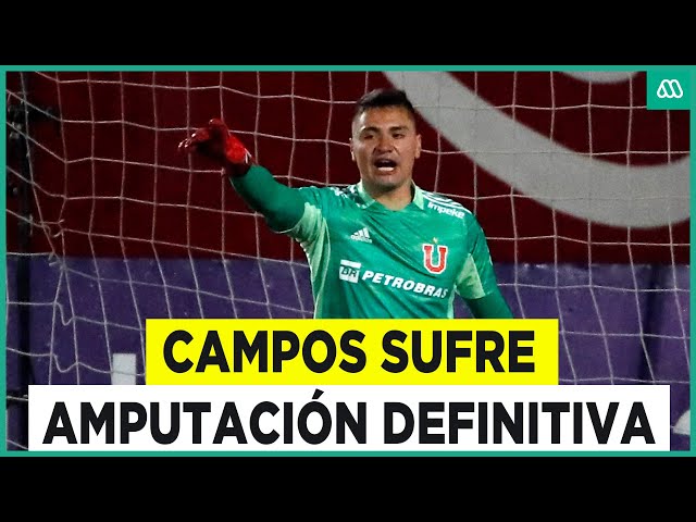 El duro momento de Cristóbal Campos: Futbolista sufre la amputación de parte de su pie derecho