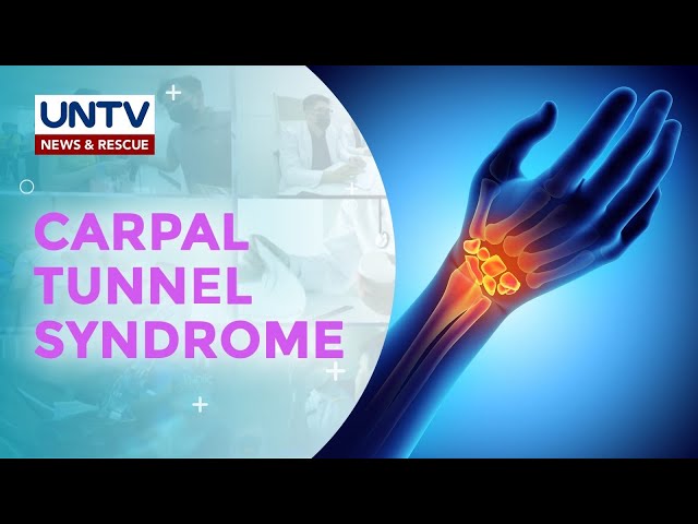 ⁣Paano malalaman kung ang isang tao ay may carpal tunnel syndrome?