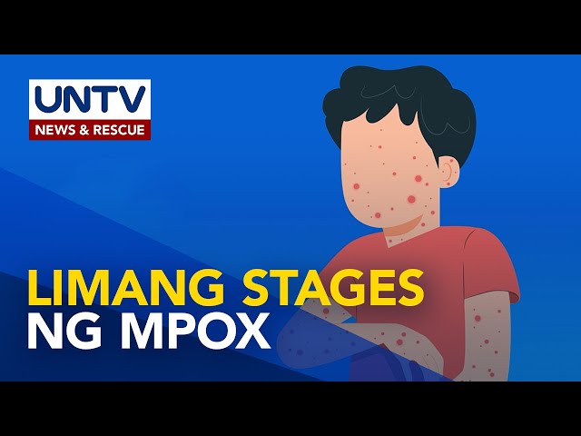 ⁣Alamin: types at stages ng mpox o monkeypox | Now You Know