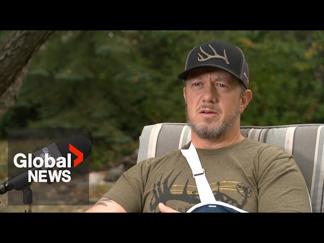 ⁣Alberta bear attack survivor shares his story: “Something you see in a horror movie”